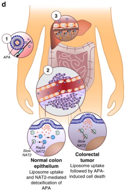 科學(xué)家發(fā)現(xiàn)治療結(jié)直腸癌的新藥(圖1) 1-200320145415191.png